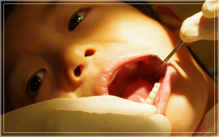 小児歯科　治療イメージ